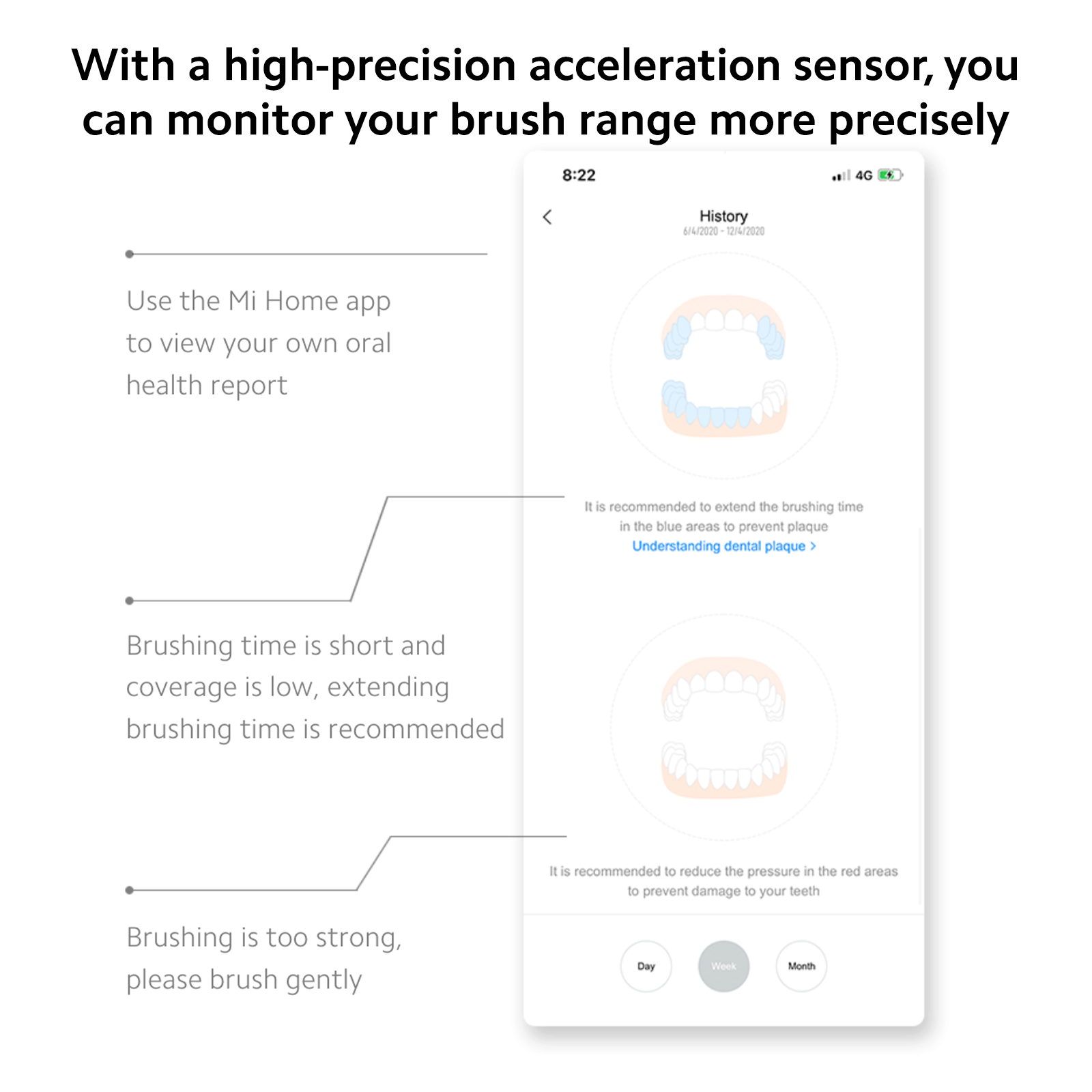 Xiaomi Mi Smart Electric Toothbrush T500